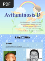 Avitaminosis D