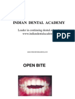 Open Bite / Orthodontic Courses by Indian Dental Academy