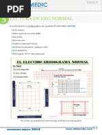 EKG Normal