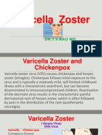 Varicella Zoster