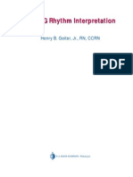 E-Z ECG Rhythm Interpretation