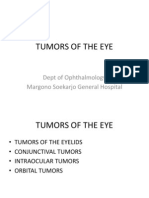 Tumors of The Eye: Dept of Ophthalmology Margono Soekarjo General Hospital