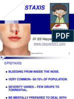 EPISTAXIS