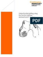 Osteochondralgraftingusing Thesmith&Nephew Mosaicplasty™System