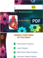 Chest Radiology