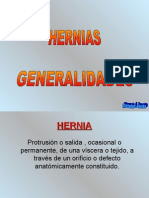 Generalidades Hernias