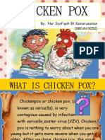 Chicken Pox Presentation