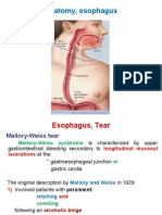 Esophagus, Tear