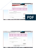 ACLS Test Printscreened