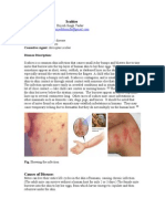 Parasitic Disease (Scabies)