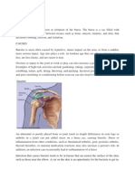 BURSITIS