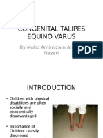 Congenital Talipes Equino Varus: by Mohd Amirnizam Ahmad Nazari