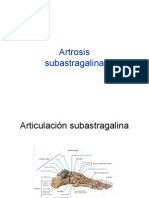 Artrodesis Subastragalina