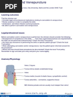 Cannulation Venepuncture Print PDF