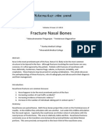 Fracture Nasal Bones