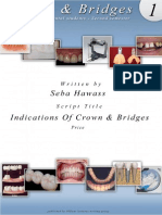 1) Indications For Crown & Bridges PDF