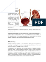 Urolithiasis