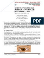 Iris Segmentation For Iris Recognititon Using Hough Transformation