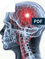 Cerebrovascular Accident