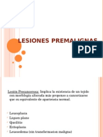 Lesiones Precancerosas Cavidad Oral