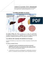 Efectos Que Causa El Alcohol en El Organismo