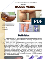 Varicose Veins