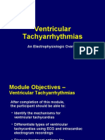 Ventricular Arrhythmias EP Overview Medtronic