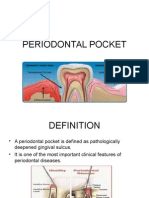 Periodontal Pocket