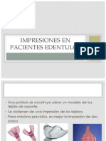 Impresiones en Pacientes Edentulos 