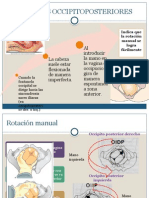 Occipito Posterior Persistente