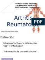 Artritis Reumatoide