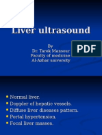 Liverultrasound