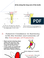 Occlusion