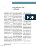 Hypomochlion Aided Reduction For Sub-Condylar Fractures