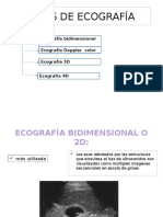 Tipos de Ecografía