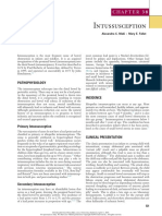 Intussusception: Pathophysiology