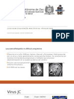 Leucoencefalopatia Multifocal Progresiva 2015 Virologia