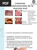 Lesiones Seudotumorales de La Mucosa Oral