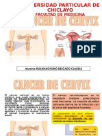 Seminario Cancer Cervix