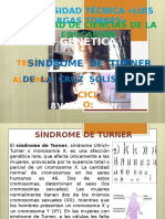 Sindrome de Turner