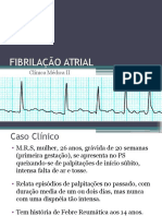 Fibrilação Atrial