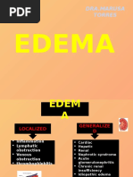 Edema