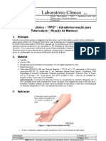 Teste Tuberculínico - "PPD" - Intradermo-Reação para Tuberculose - Reação de Mantoux