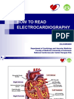 ECG Interpretation