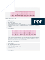 ECG Reading