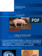 Triquinosis