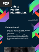 Quiste Mandibular Medio