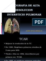 Diagnóstico Por Imagen II - Tomografía, Intersticio Pulmonar