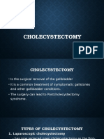 Cholecystectomy