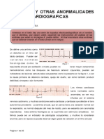 Arritmias Cardiacas